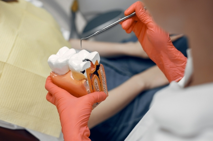 Wisdom Tooth Extraction